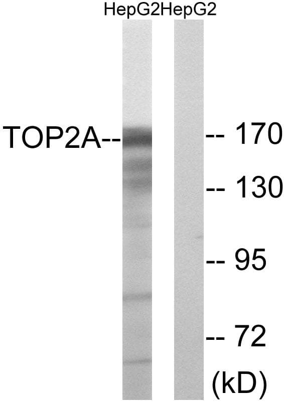 TOP2A / Topoisomerase II Alpha Antibody (p1343)