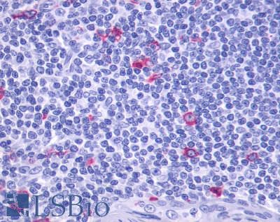 IHC-plus™ Polyclonal Rabbit anti-Human GPR137 Antibody (Extracellular Domain, IHC)