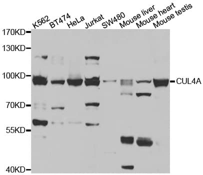 IHC-plus™ Polyclonal Rabbit anti-Human Cullin 4A / CUL4A Antibody (IHC, IF, WB)