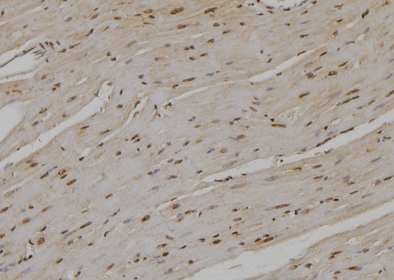 UBE2D1 / UBCH5 Antibody