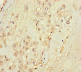 TLN2 / Talin 2 Antibody