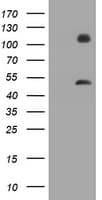 IHC-plus™ MAGEA3 Antibody (clone 2F10)
