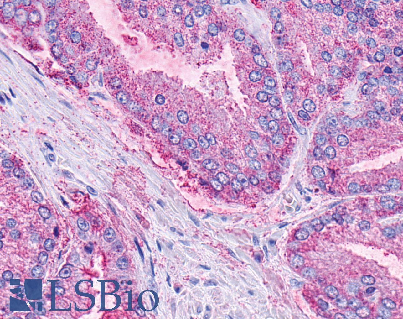 PathPlus™ LPAR6 / P2RY5 / P2Y5 Antibody (Extracellular Domain)