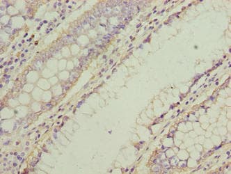 NMUR1 Antibody