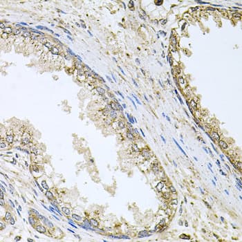 CYP46A1 / CYP46 Antibody