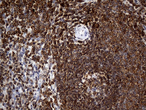 Monoclonal Mouse anti-Human CRLF3 Antibody (clone OTI2A10, IHC, WB)