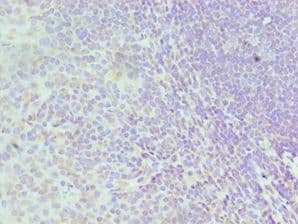 Polyclonal Rabbit anti-Human HNRNPD / AUF1 Antibody (aa1-306, IHC, WB)