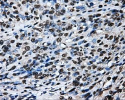 LOX / Lysyl Oxidase Antibody (clone OTI9G6)
