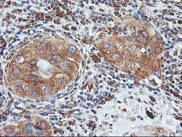 ILVBL Antibody (clone OTI8B12)