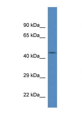 FBXL20 Antibody (aa110-159)
