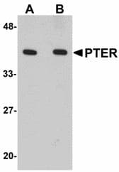 IHC-plus™ Polyclonal Rabbit anti-Human PTER Antibody (IHC, WB)