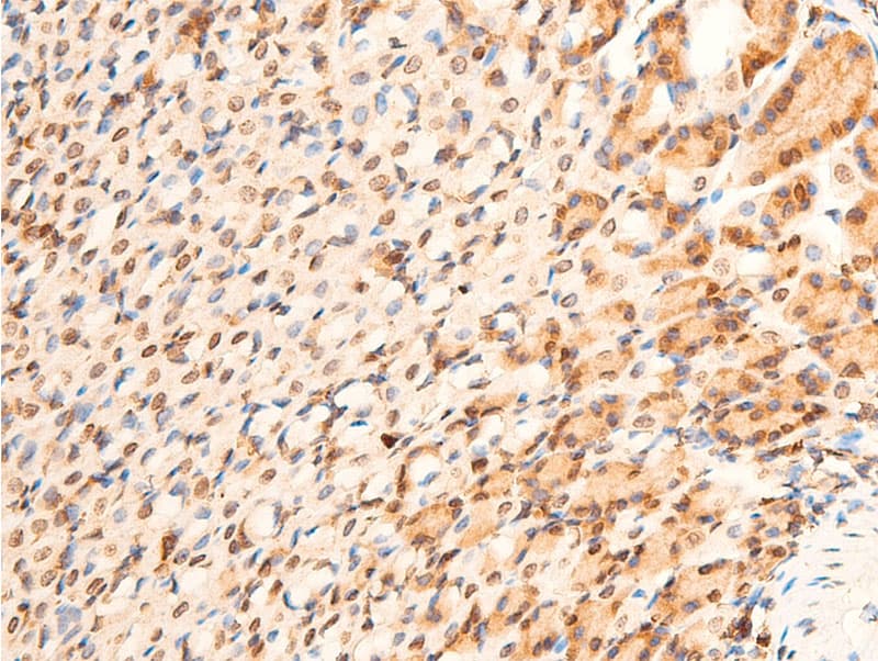 TP73 / p73 Antibody (phospho-Tyr99)