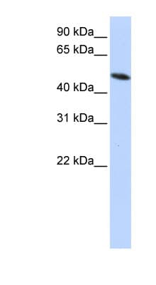 PDIA6 / ERP5 Antibody (aa216-265)