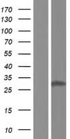 NQO1 Protein (Over-Expression Lysate Myc-DDK (Flag))