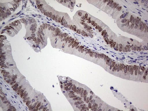HDAC9 Antibody (aa181-460, clone OTI6E2, Carrier-free)