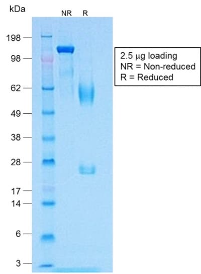 Recombinant Monoclonal Rabbit anti-Human MLANA / Melan-A Antibody (clone MLANA/1409R, Azide-free,Carrier-free, IHC)