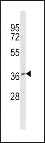 Polyclonal Rabbit anti-Human BMI1 / PCGF4 Antibody (IHC, IF, WB)