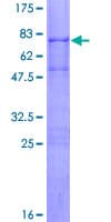 Human TOB1 / TOB Protein (Recombinant GST)