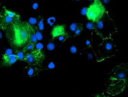 PDLIM2 / SLIM Antibody (clone OTI3B5)