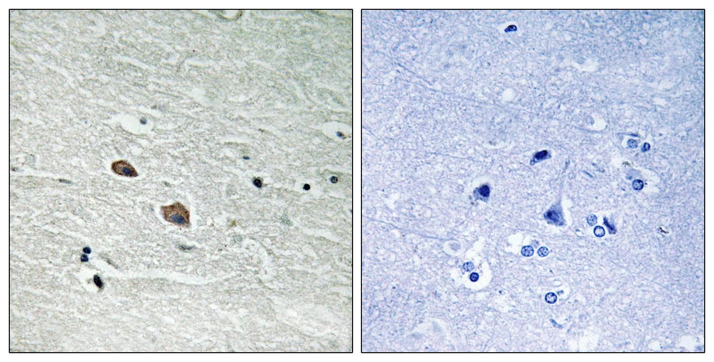 MAP3K7 / TAK1 Antibody (p439)
