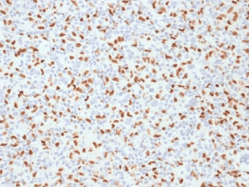 Monoclonal Mouse anti-Human SPI1 / PU.1 Antibody (clone PU1/2146, IHC, WB)