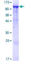 Human KLHL11 Protein (Recombinant GST)