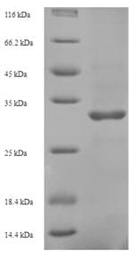 Hepatitis B Virus Protein X (Recombinant 6His-SUMO, N-terminus)