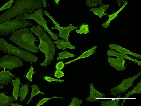 CTLA4 / CD152 Antibody (clone 2F1)