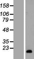 SAA2 / Serum Amyloid A2 Protein (Over-Expression Lysate Myc-DDK (Flag))