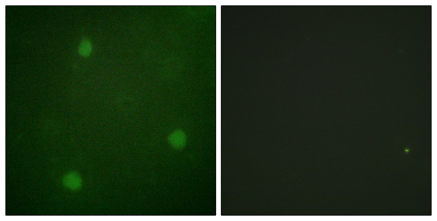 DCLRE1C / Artemis Antibody (aa482-531)