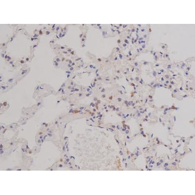 Polyclonal Rabbit anti-Human BCL2L1 / BCL-XL Antibody (phospho-Thr47, IHC, IF, WB)