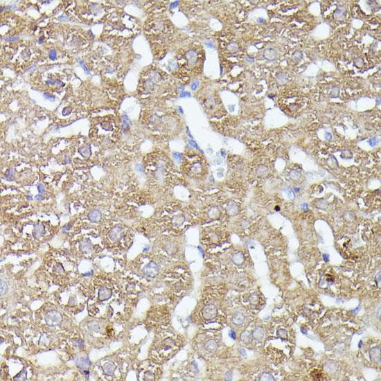 HSPC167 / CDK5RAP1 Antibody