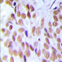 HMG1 / HMGB1 Antibody (Internal)