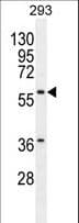 CPA2 Antibody (aa179-208)