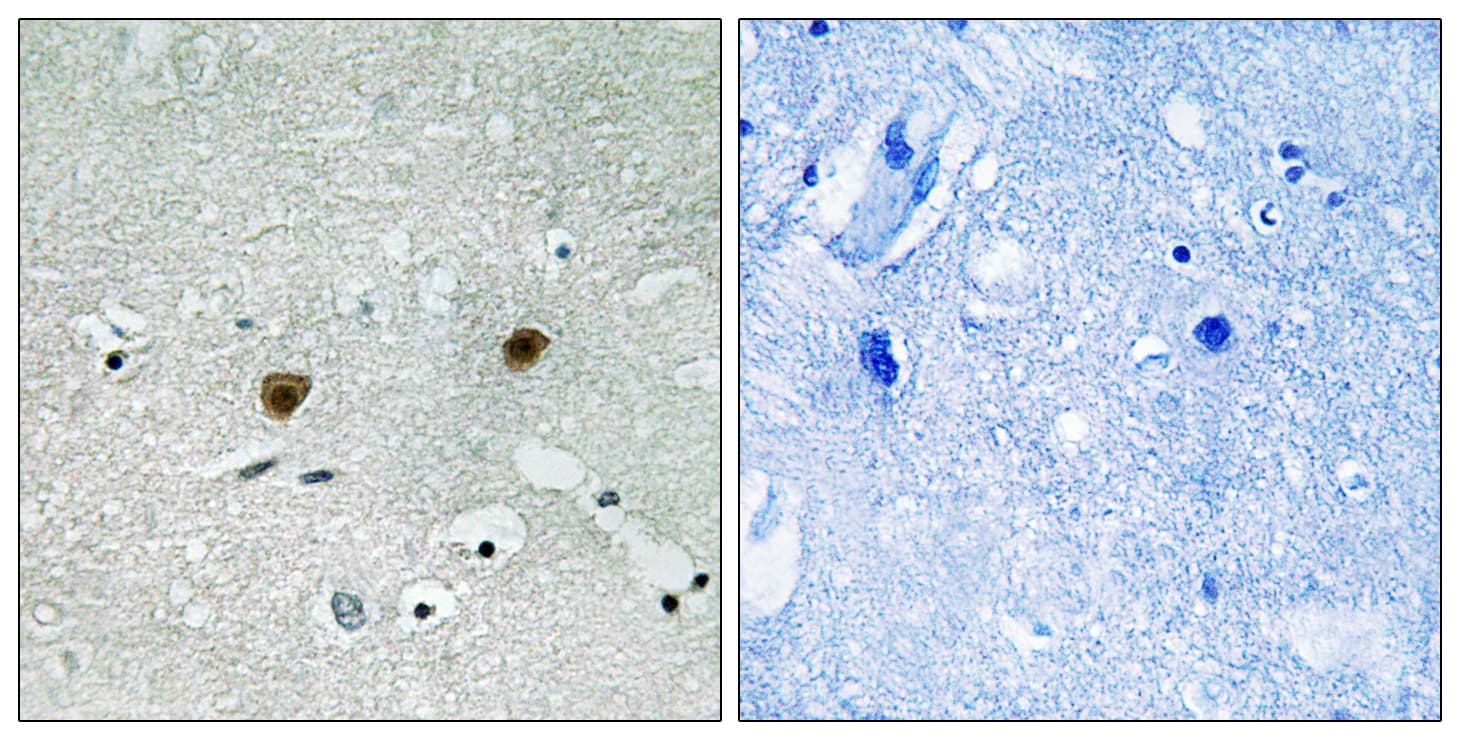 Polyclonal Rabbit anti-Human AKT1 + AKT2 + AKT3 Antibody (phospho-Tyr315/Tyr316/Tyr312, IHC)