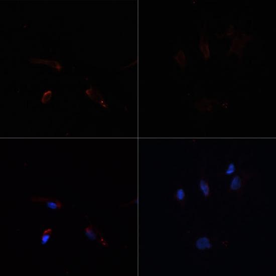 Acetyl-CoA Carboxylase / ACC Antibody
