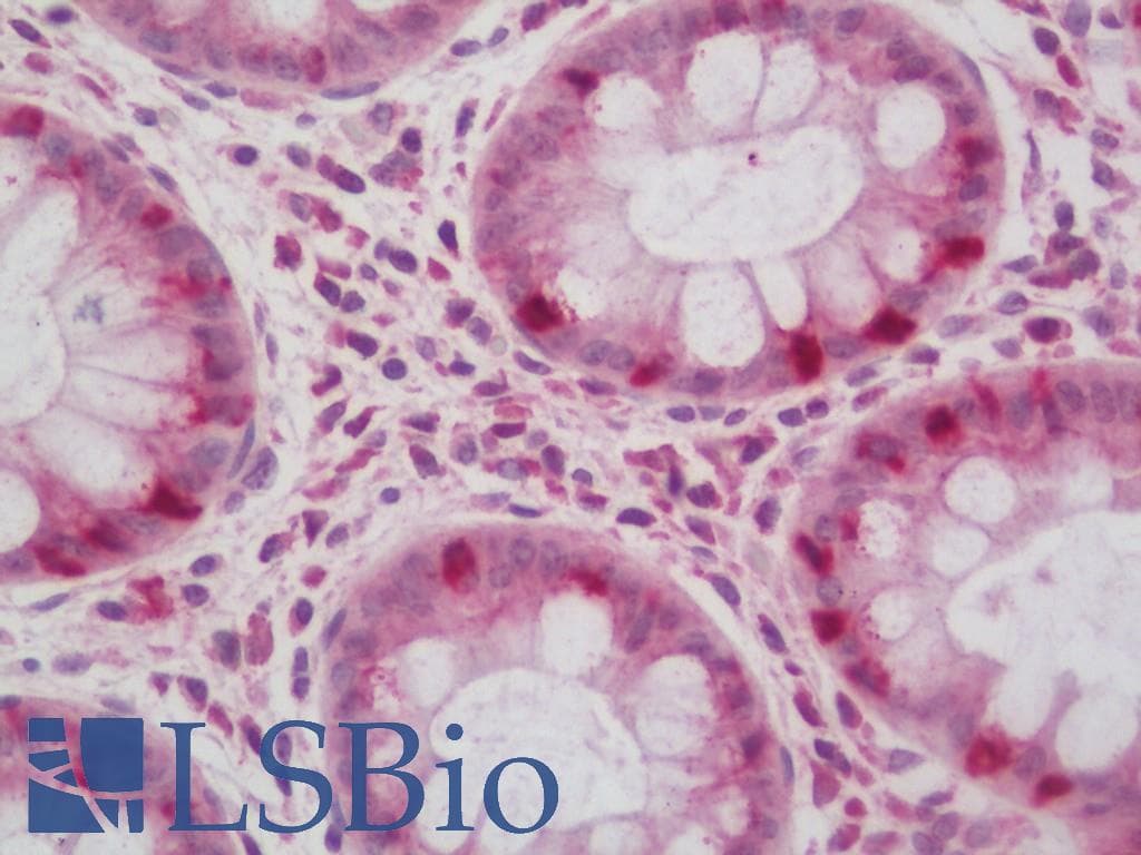 TBCC Antibody (HRP)
