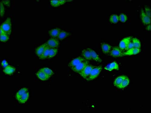 Polyclonal Rabbit anti-Human DPYD / DPD Antibody (IF)