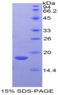 Mouse LYAR Protein (Recombinant His-T7)