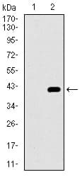 ITGA2B / CD41 Antibody (aa45-149, clone 2E10C9)