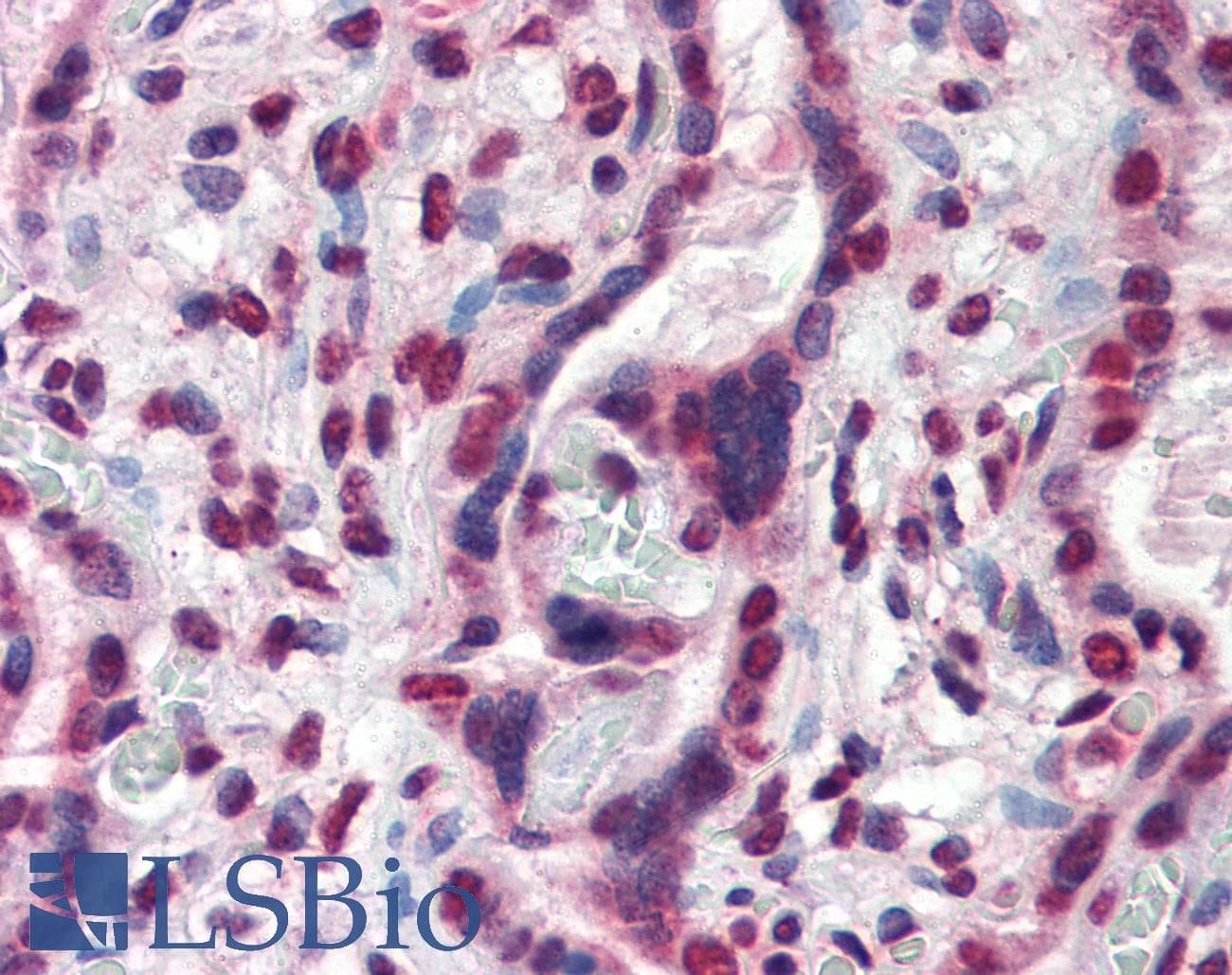 IHC-plus™ Monoclonal Mouse anti-Human ATF6 Antibody (clone 70B1413.1, aa1-273, IHC, WB)