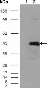 IHC-plus™ Monoclonal Mouse anti-Human BHMT Antibody (clone 8C11H5, IHC, WB)