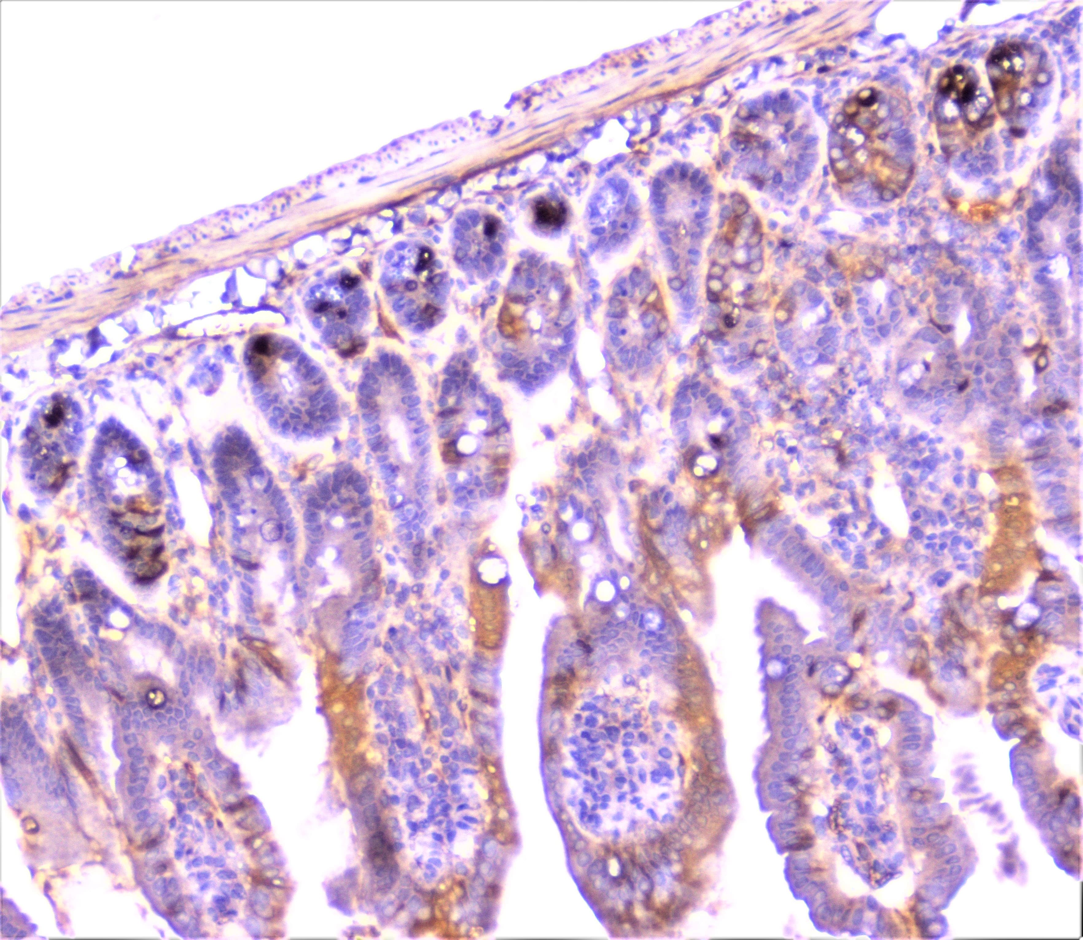 CRP / C-Reactive Protein Antibody
