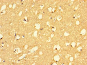 RIT2 / RIN Antibody