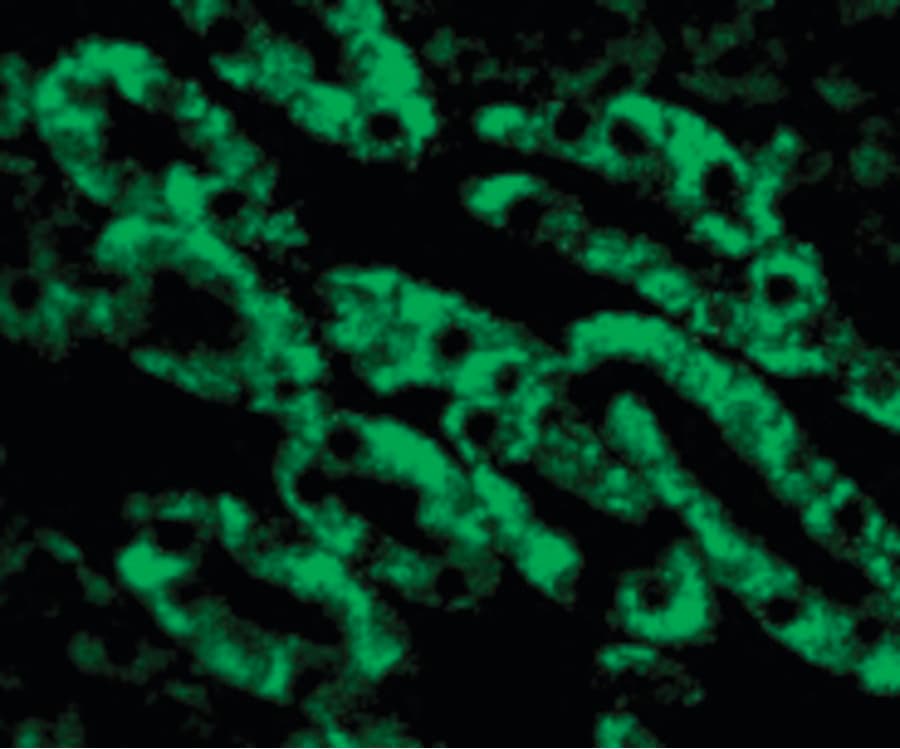 DFFB Antibody
