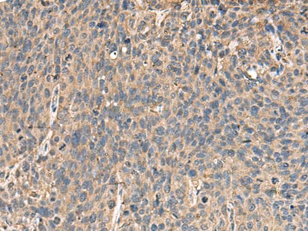 MRPL42 / MRPS32 Antibody
