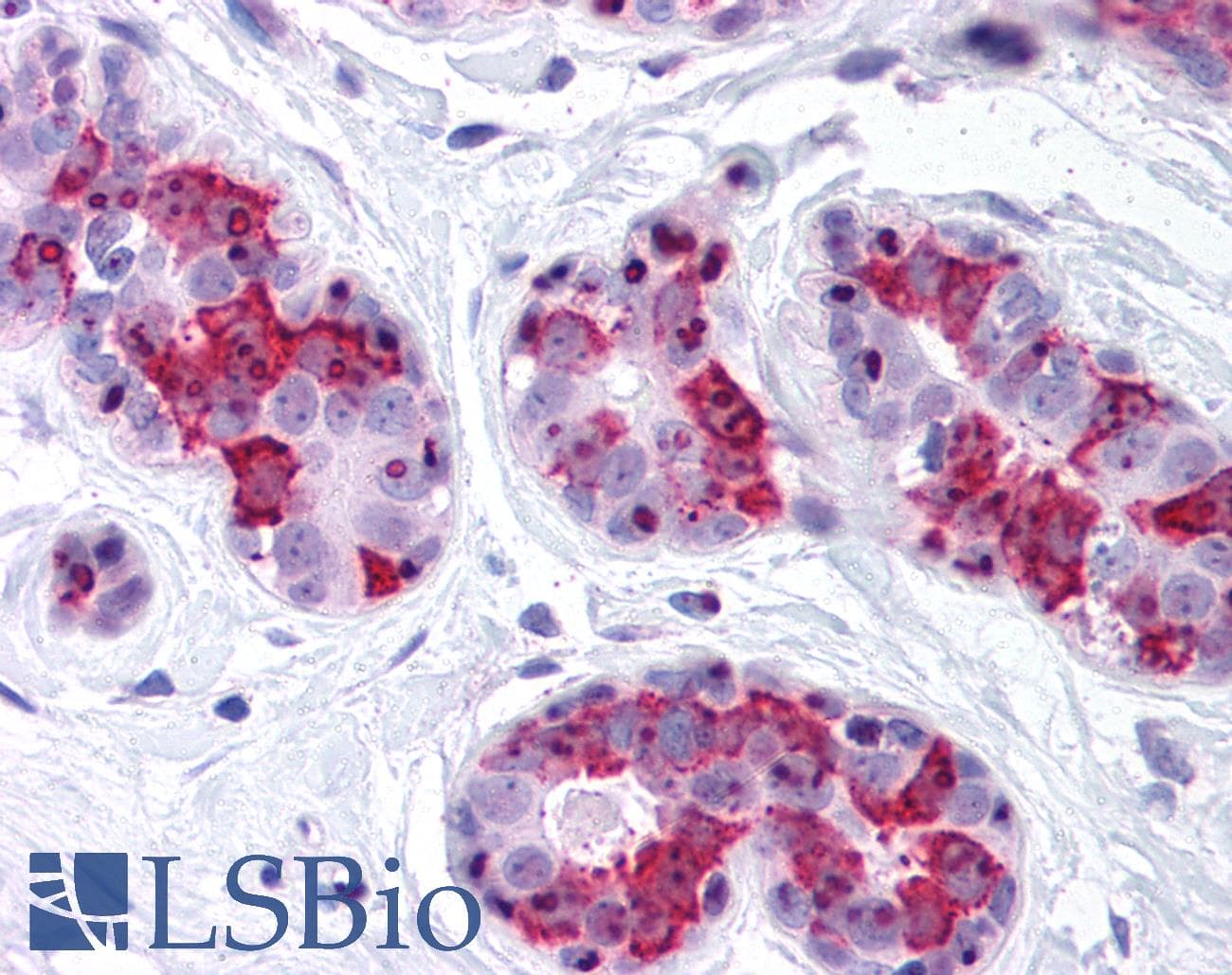 IHC-plus™ Polyclonal Rabbit anti-Human BAG5 Antibody (IHC, WB)