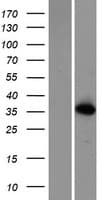 CTU1 Protein (Over-Expression Lysate Myc-DDK (Flag))