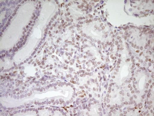 MEF2D Antibody (aa1-282, clone OTI1E11, Carrier-free)