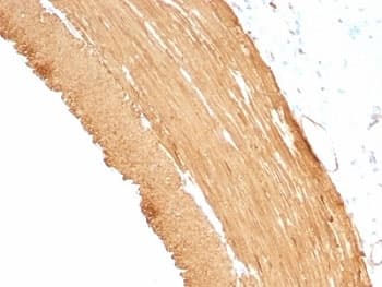 Muscle Actin Antibody (clone MSA/953)